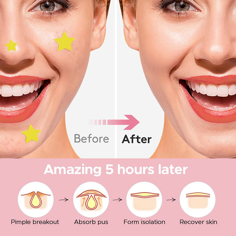 600Pcs/set Star Pimple Patch A - огляд і ціна Beauty Makeup & D Anime Studio